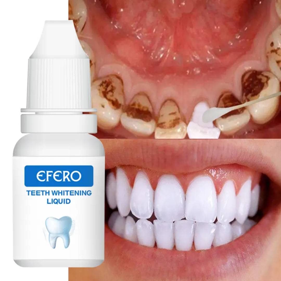 ✨ EFERO Teeth Whitening Essence – Instantly Brighten Your Smile! ✨